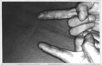 pulp finger